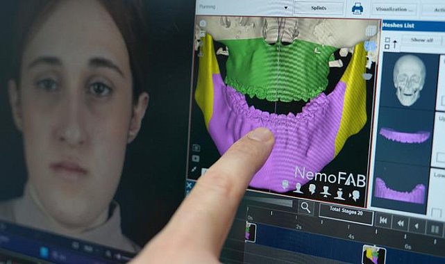 İkizlerin dijital mucizesi: Yapay zeka destekli çene ameliyatıyla yeni bir hayata 'merhaba'
