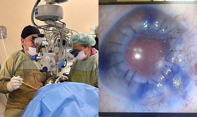 Kastamonu'da bir ilk! 25 yıllık görme kaybı son buldu