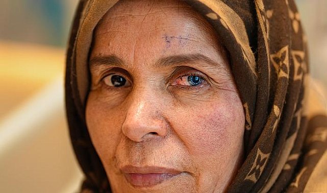 Libya’lı kadına “Asla göremezsin” dediler! Türkiye’de tedavisini buldu