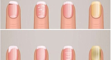 Tırnaklarınız ömrünüzü gösteriyor: Eğer tırnaklarınız bu şekildeyse daha uzun yaşayacaksınız