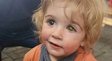 2 yaşındaki çocuk ‘öpücük’ yüzünden kör oldu!