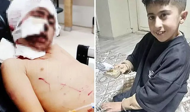 Erzurum’da 10 yaşındaki çocuğu köpekler parçaladı! Baba: “Kanlar içinde tanınmaz haldeydi”