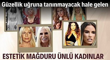 Güzellik uğruna estetik yaptırıp tanınmayacak hale gelen estetik mağduru ünlü kadınlar