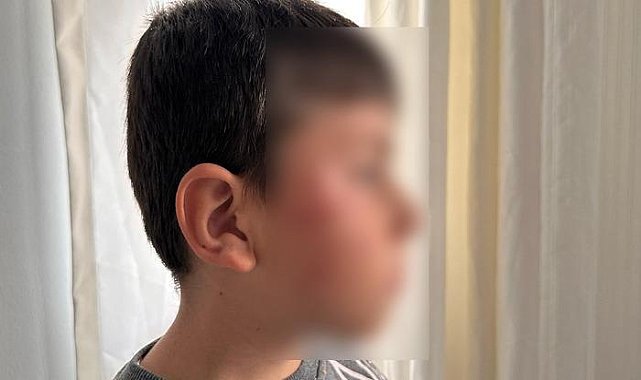 İlkokulda dayak skandalı: Gözü dönen anne, oğlu ile kavga eden çocuğu hastanelik etti!
