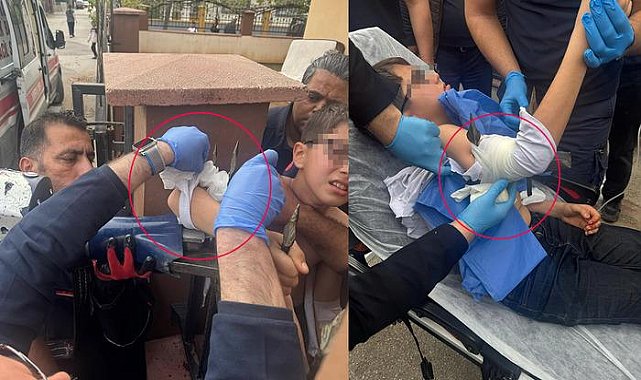 Korkunç olay! Dengesini kaybedince koluna demir parmaklık girdi