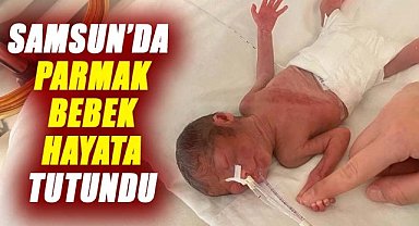 Samsun’da parmak bebek Aylin hayata tutundu