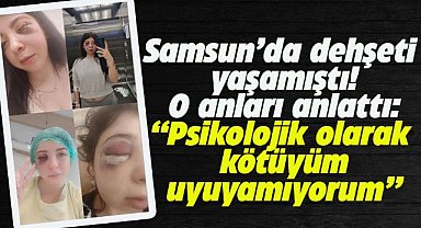 Samsun'da yolda yürürken sözlü tacize uğradı ve darp edildi! Damla Korkmaz dehşet anlarını anlattı