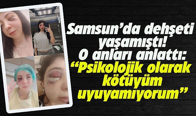 Samsun'da yolda yürürken sözlü tacize uğradı ve darp edildi! Damla Korkmaz dehşet anlarını anlattı