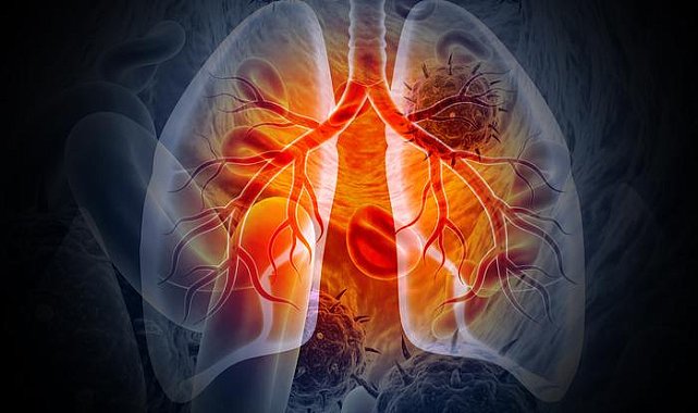 Türkiye'de tüberküloz oranı düşüşte