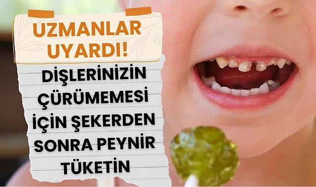Uzmanlar uyardı : Dişlerinizin çürümemesi için şekerden sonra peynir tüketin