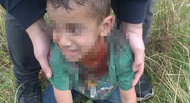 Yalova’da sokak köpeği 5 yaşındaki çocuğa saldırdı! Boğazından yaraladı, durumu ağır