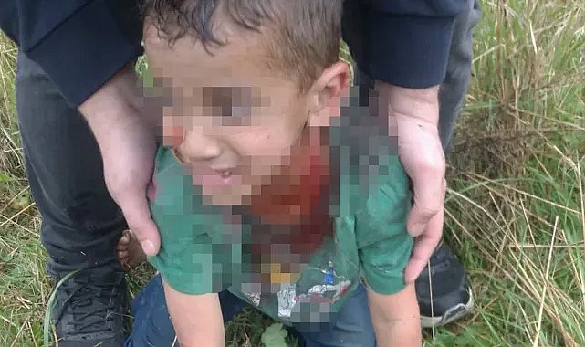 Yalova’da sokak köpeği 5 yaşındaki çocuğa saldırdı! Boğazından yaraladı, durumu ağır