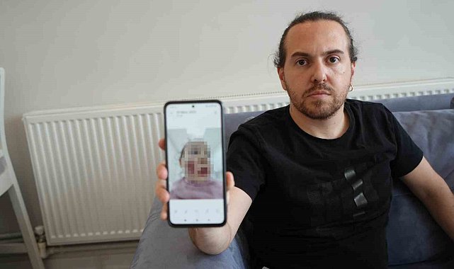 Bakanlıktan 2 yaşındaki çocuğun darp olayına ilişkin açıklama