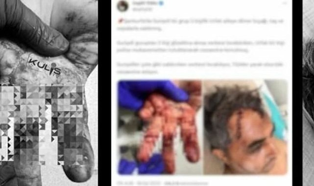 Suriyeliler döner bıçağı taş ve sopalarla Türk aileye saldırdı