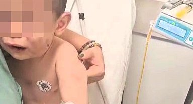 Annesinin erkek arkadaşı tarafından darp edilen 2 yaşındaki bebek hastanelik oldu!