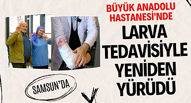 Samsun'da Büyük Anadolu Hastanesi'nde 59 yaşındaki hasta larva tedavisiyle yeniden yürüdü