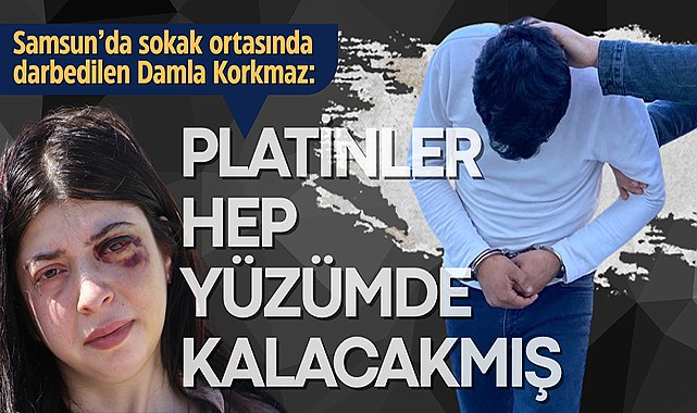 Samsun'da sokak ortasında darbedilen Damla: Platinler hep yüzümde kalacakmış