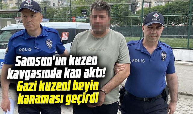 Samsun'un kuzen kavgasında kan aktı! Gazi kuzeni beyin kanaması geçirdi
