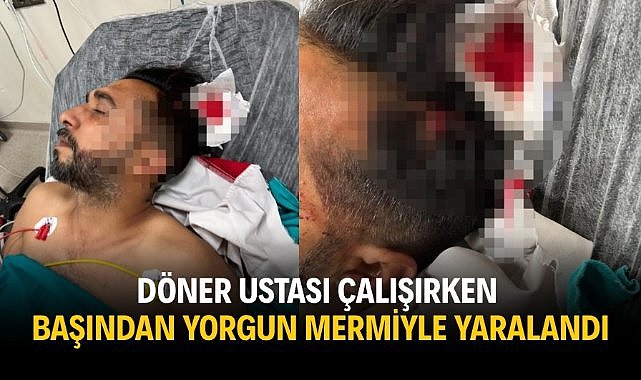 Döner ustası çalışırken başından yorgun mermiyle yaralandı