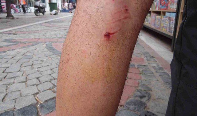 Başıboş 8 köpek, köpeğini gezdiren vatandaşa saldırdı