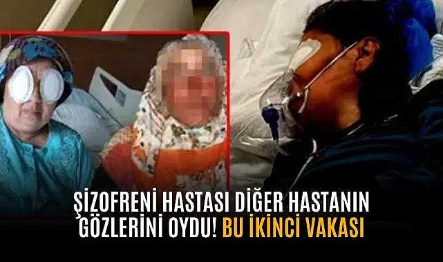 Şizofreni hastası diğer hastanın gözlerini parmaklarıyla oydu! Bu ikinci vakası!