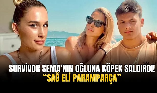 Survivor Sema’nın oğluna köpek saldırdı! “Sağ eli paramparça”
