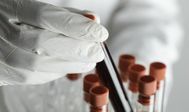 Tıp dünyasında ilk! Yeni kan grubu keşfedildi! Hiçbir testle uyumlu değil...