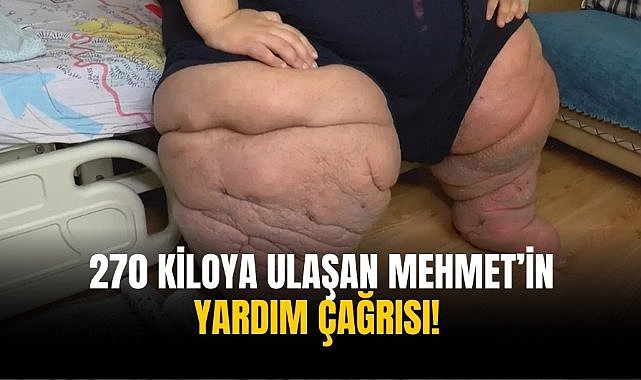 270 kiloya ulaşan Mehmet’in yardım çağrısı! 