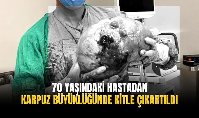 70 yaşındaki hastadan karpuz büyüklüğünde kitle çıkartıldı
