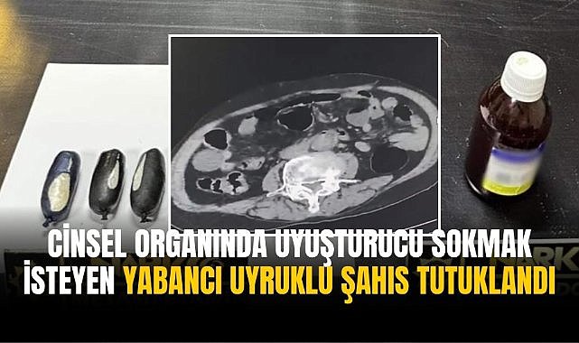 Cinsel organında uyuşturucu sokmak isteyen yabancı uyruklu şahıs tutuklandı