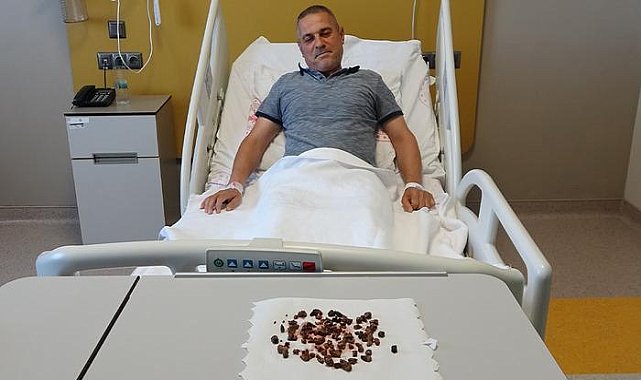 Doktorları şaşkına çeviren vaka: Adamın böbreğinden 100'e yakın taş çıktı