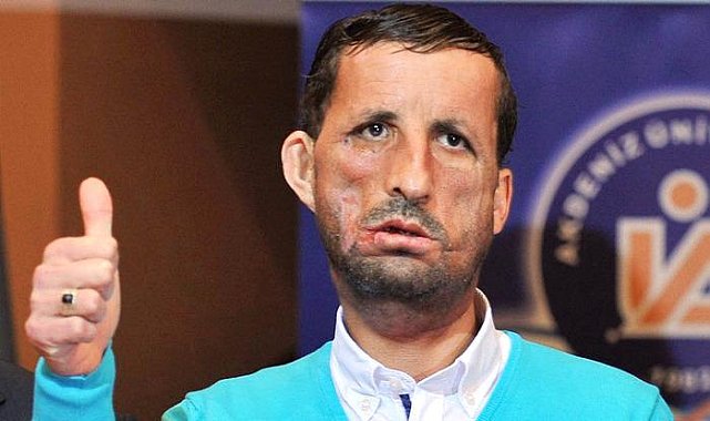 'İlklerin merkezi' 50 yıllık organ nakli üssüne yenisini ekledi: Akciğer nakline başlıyor...