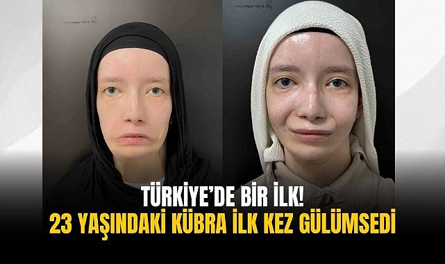 Türkiye’de bir ilk! 23 yaşındaki Kübra ilk kez gülümsedi