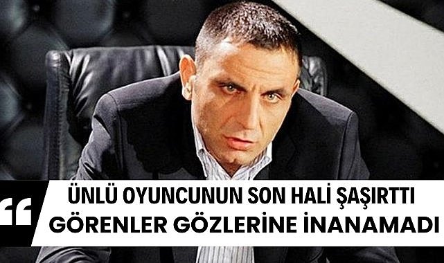 Ünlü oyuncunun son hali şaşırttı
