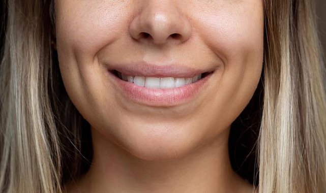 Yeni estetik çılgınlığı: Gamzeplasti ameliyatı sosyal medyada yayılıyor!