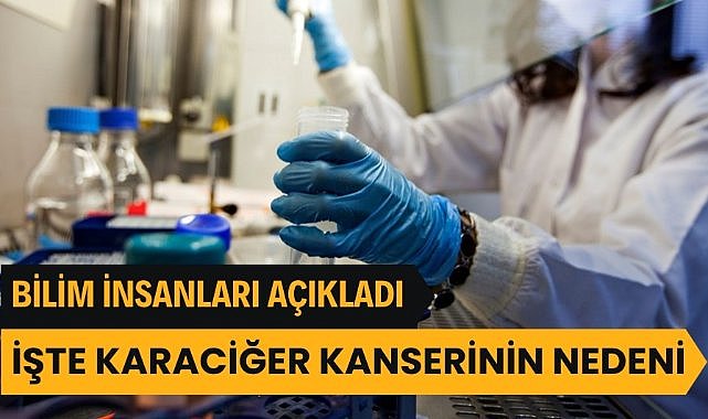 Bilim insanları, karaciğer kanserinin temel nedenini keşfetti
