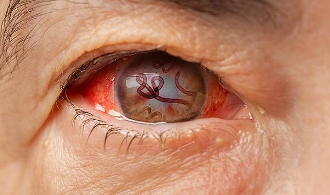 Korkunç hastalık: Resmen içerden çürütüyor! Ebola benzeri virüs 8 kişinin canını aldı