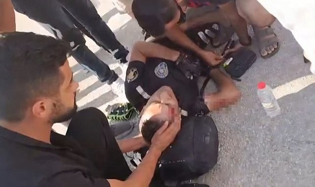 Motosikletli trafik polisi, kazada ağır yaralandı