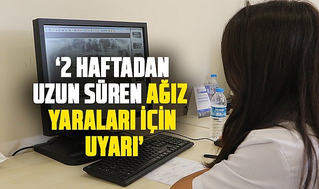 Samsun'da doktordan 2 haftadan uzun süren ağız yaraları için uyarı