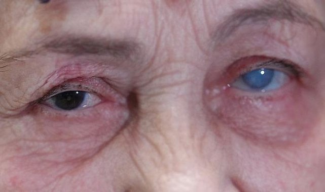 Sisler içinden aydınlığa kavuştu! Resmen ikinci kez hayata gözlerini açtı