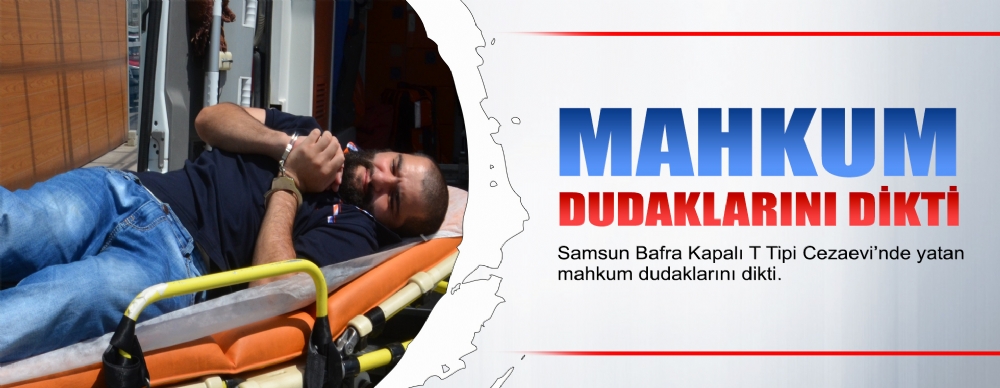 Mahkum Dudaklarını Dikti