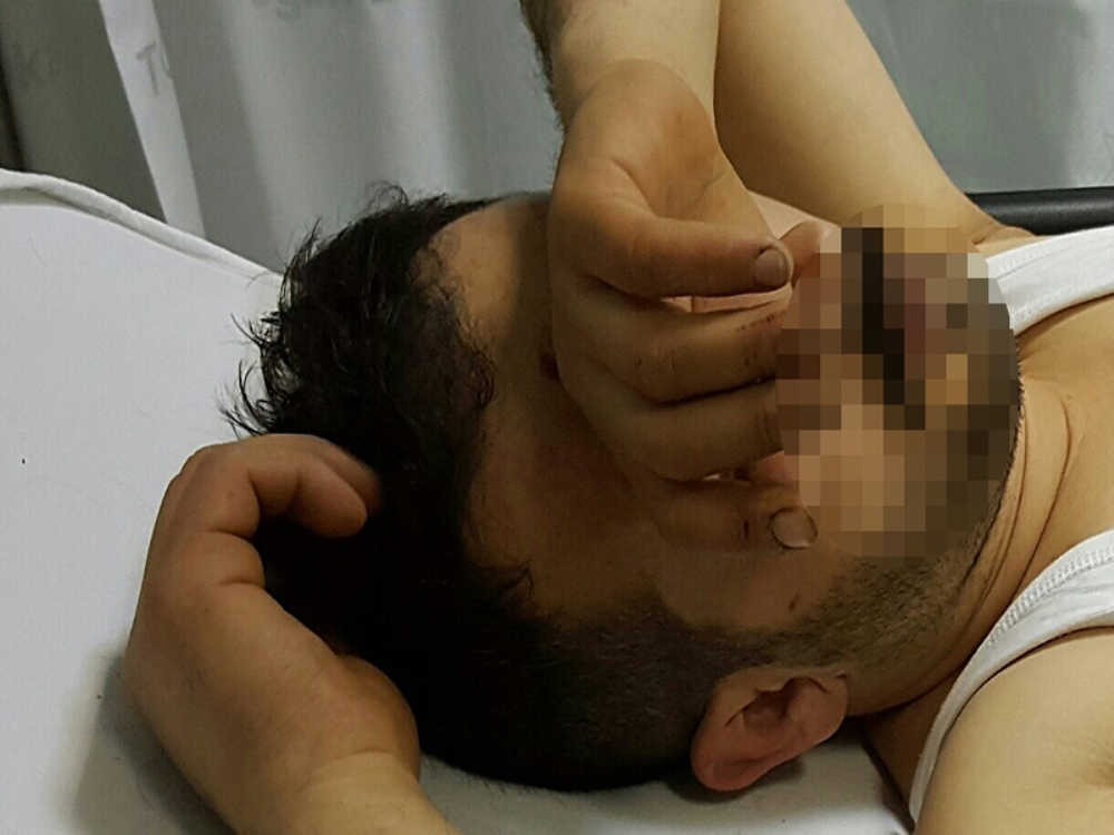 Pavyonda Bıçaklandı