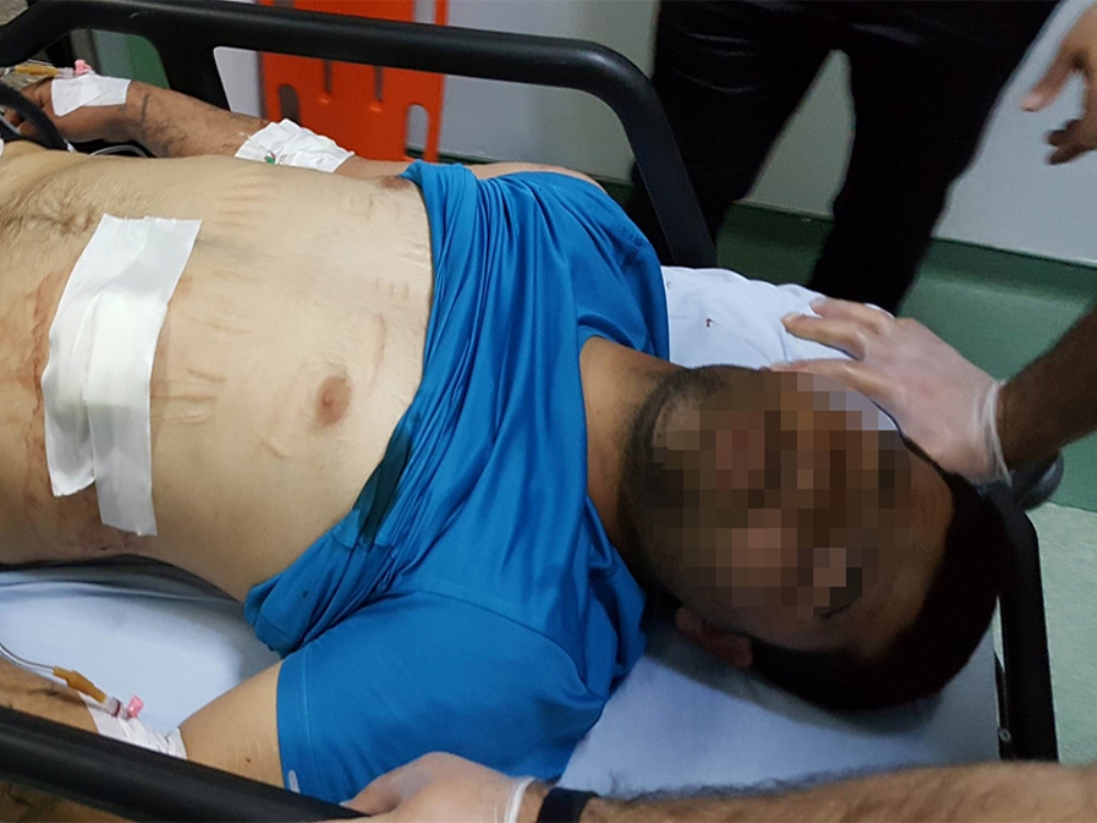 Asker Eğlencesinde 3 Kişi Hastanelik Oldu