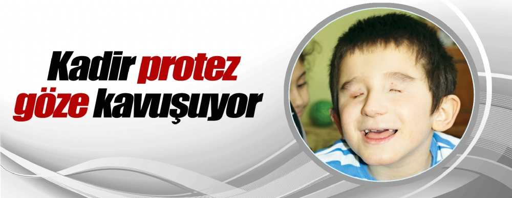 Kadir Protez Goze Kavusuyor Guncel
