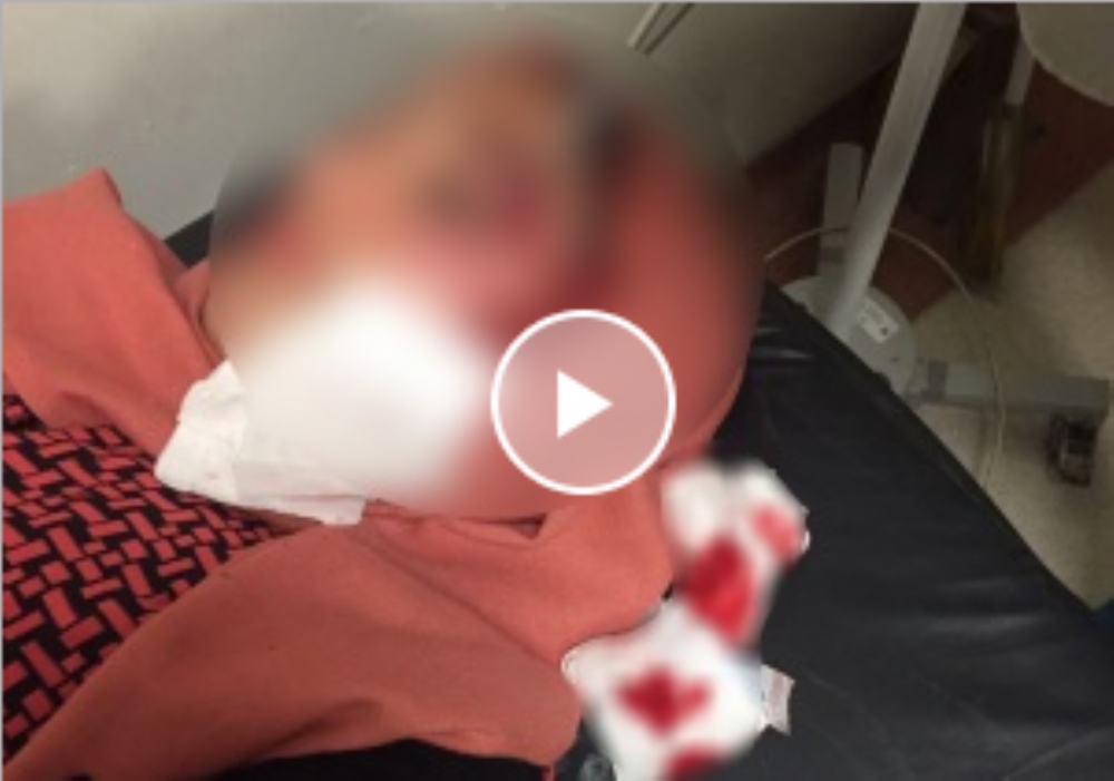 Ak Parti’li Kadınlara Taşlı Saldırı: 2 Yaralı