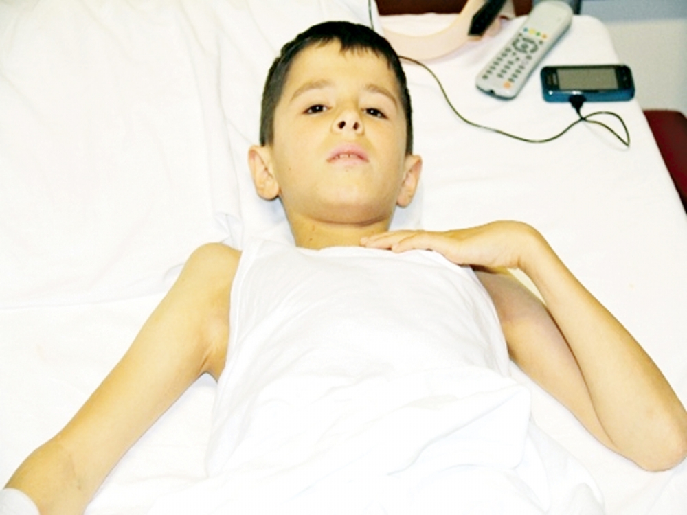 12 Yaşındaki Sezer'i Kamburluktan Kurtaran Ameliyat