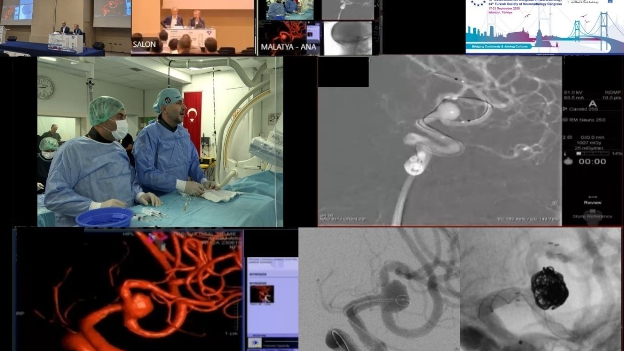 Canlı yayında  beyin ameliyatı yaptılar