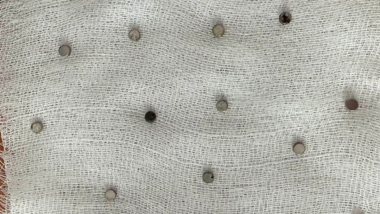 Çocuğun boğazından 19 adet mıknatıs çıkartıldı