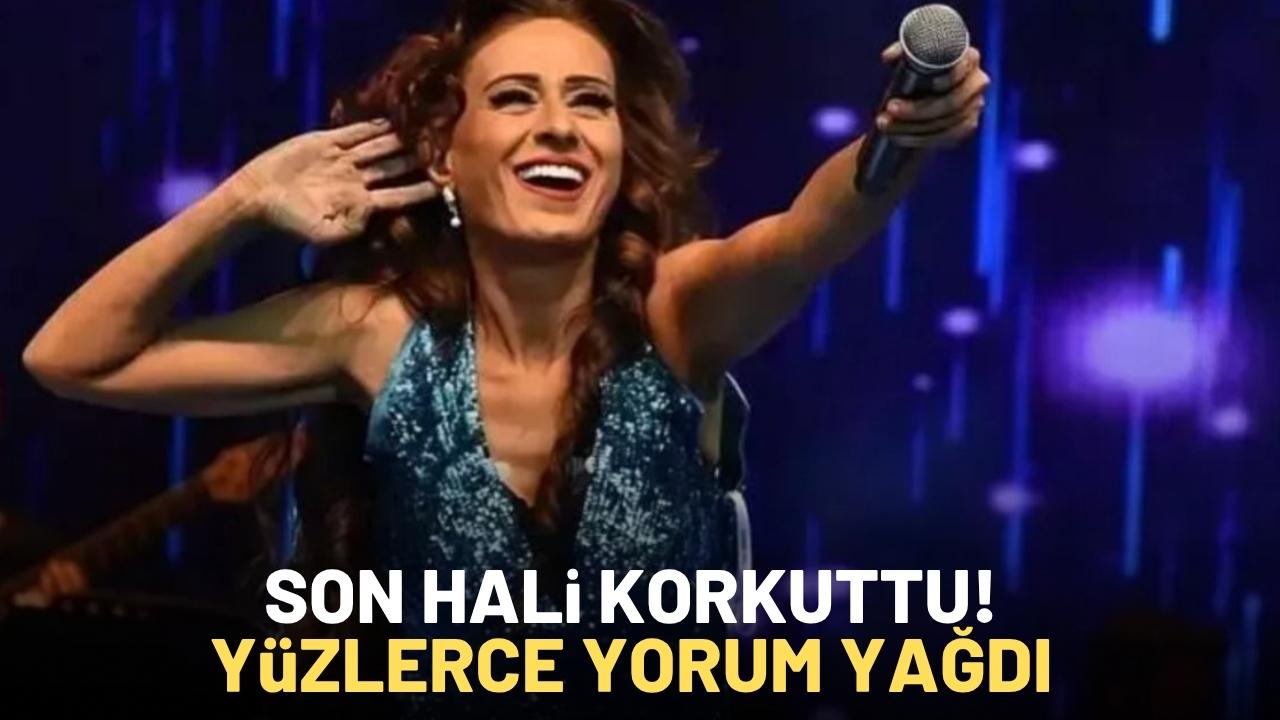 Yıldız Tilbe'den yeni paylaşım: Yüzünün hali endişelendirdi