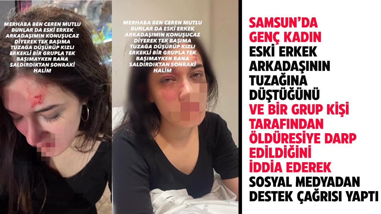 Samsun'da kadına öldüresiye darp iddiası! Ceren Mutlu destek istedi! "Eski erkek arkadaşım tuzak kurdu"